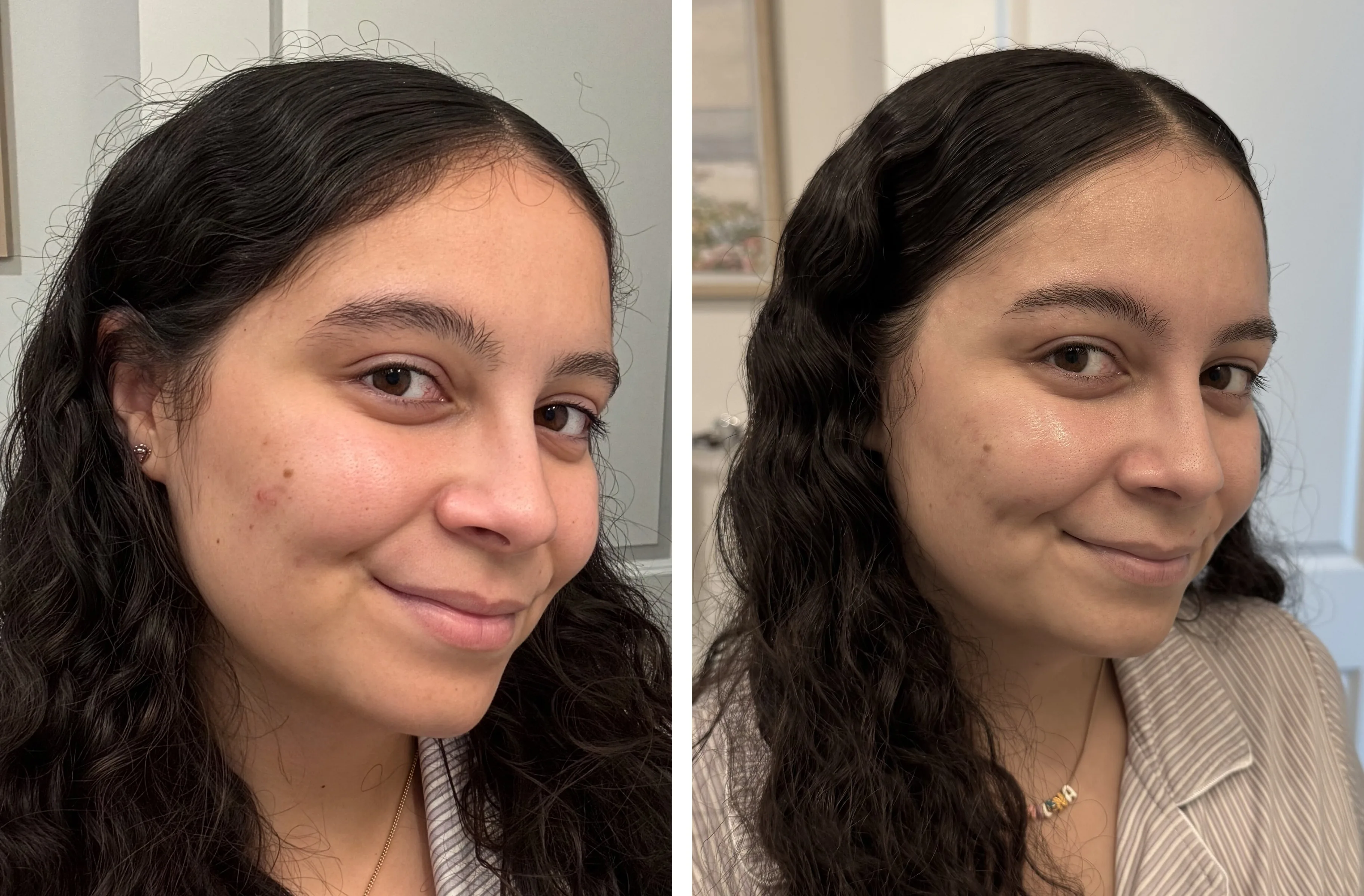 Maggie, 14 days on Renew, full size